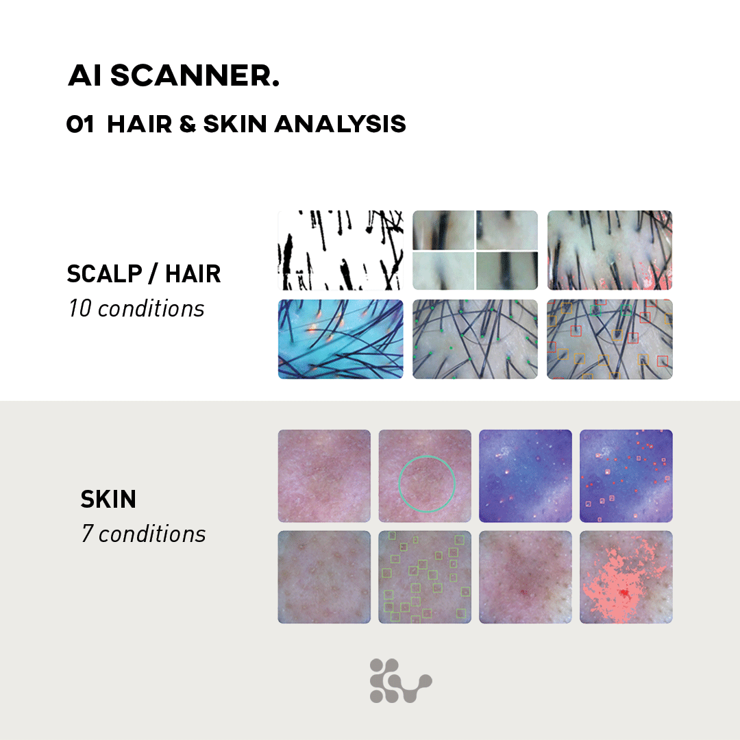 AI Skin Scanner