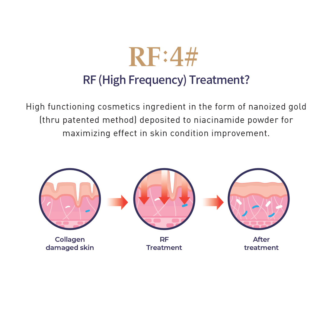 "RF:4# High Frequency Treatment infographic showing collagen-damaged skin before treatment, RF treatment with nanoized gold and niacinamide, and improved skin condition after treatment."
