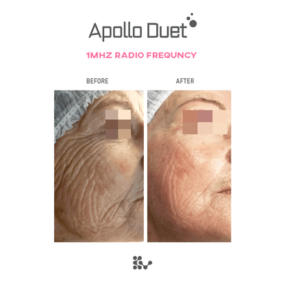 Weero Apollo Duet APD-4000