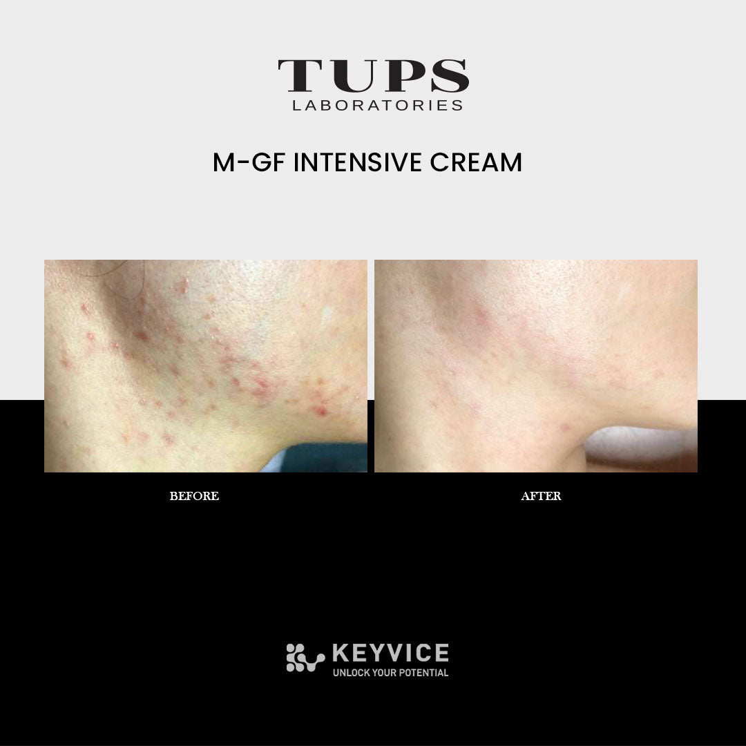 TUPS SKINCARE LINEUP- M-GF Intensive cream before and after