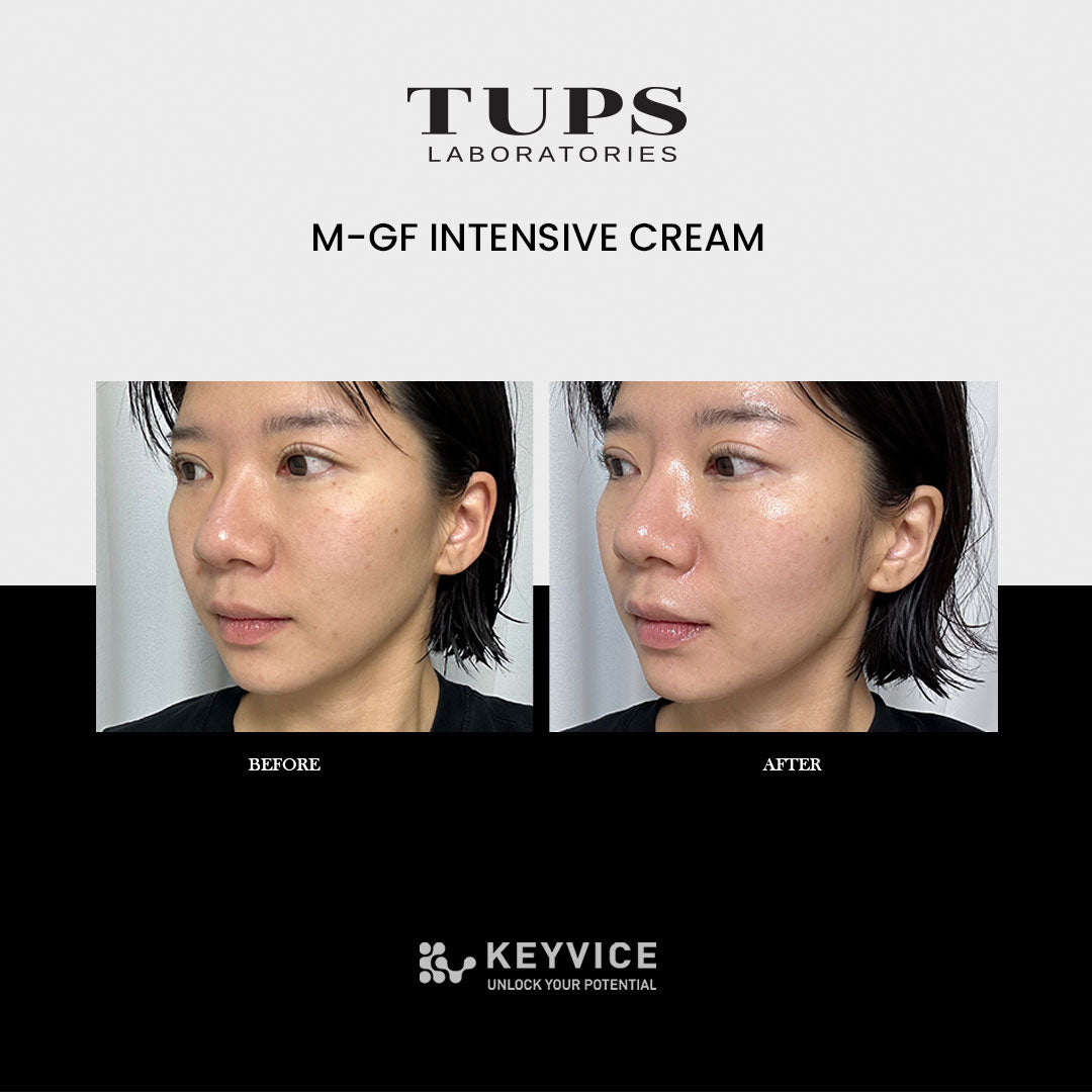 TUPS SKINCARE LINEUP- M-GF Intensive Cream before and after