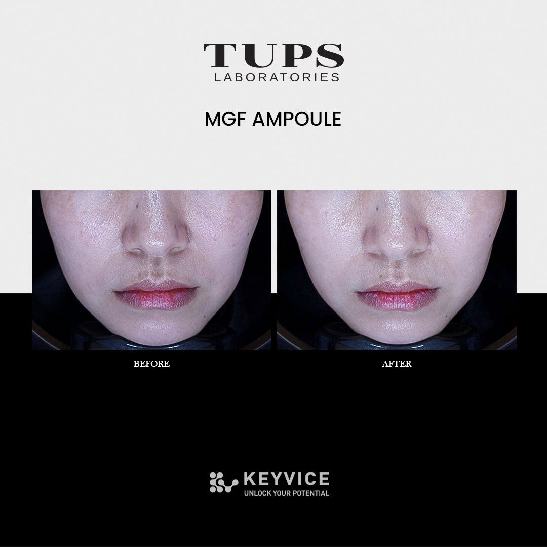 TUPS SKINCARE LINEUP= M-GF Ampoule Before and after