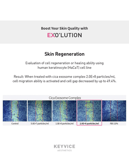 Boost your skin quality with Exo’lution—skin regeneration test on human keratinocyte (HaCaT) cells showing cica exosome complex treatment activates cell migration and reduces cell gap by up to 49.4%