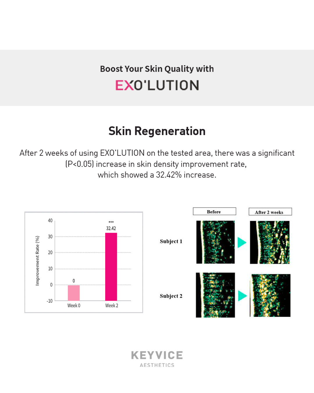 Exo’lution skin regeneration results after two weeks, showing a significant 32.42% increase in skin density improvement rate (P<0.05)